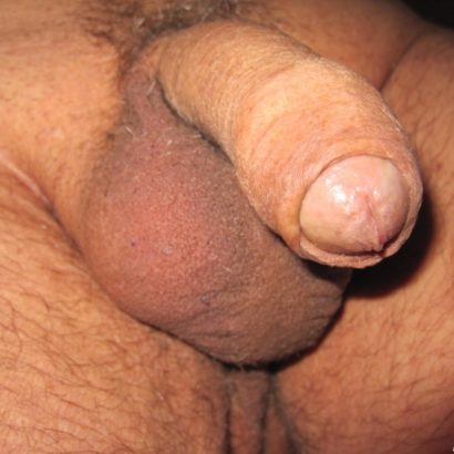 schlaffer Penis halb rasiert